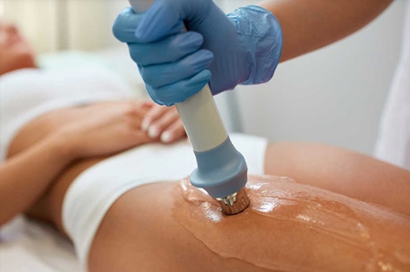 Soin lipocavitation pour combattre la cellulite réalisé à l'atelier beauty Dakar au Sénégal